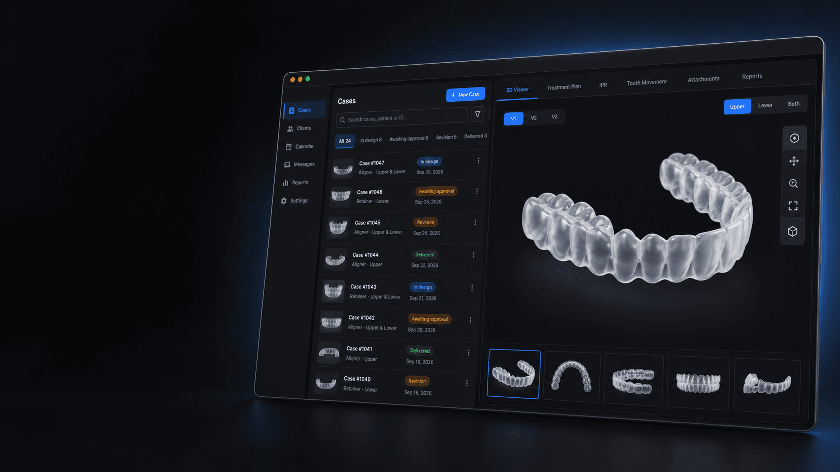 Dental lab case dashboard with a 3D treatment-plan viewer